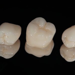 Ceramic dental crowns on the mirror, chewing teeth