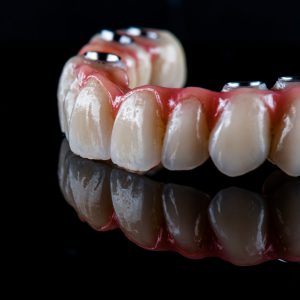 full arch ceramic bridge on implants