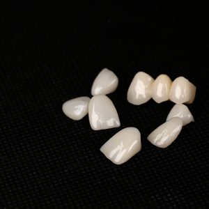dental ceramic crowns, laminate veneers. 3d printed dental model